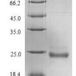 SDS-PAGE separation of QP7823 followed by commassie total protein stain results in a primary band consistent with reported data for VWA5B2. These data demonstrate Greater than 90% as determined by SDS-PAGE.