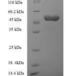 SDS-PAGE separation of QP7825 followed by commassie total protein stain results in a primary band consistent with reported data for ACBD4. These data demonstrate Greater than 90% as determined by SDS-PAGE.