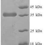 SDS-PAGE separation of QP7832 followed by commassie total protein stain results in a primary band consistent with reported data for PTPMT1. These data demonstrate Greater than 90% as determined by SDS-PAGE.