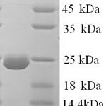 SDS-PAGE separation of QP7837 followed by commassie total protein stain results in a primary band consistent with reported data for Dystonin. These data demonstrate Greater than 90% as determined by SDS-PAGE.