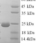 SDS-PAGE separation of QP7837 followed by commassie total protein stain results in a primary band consistent with reported data for Dystonin. These data demonstrate Greater than 90% as determined by SDS-PAGE.