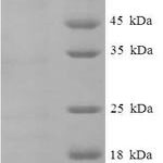 SDS-PAGE separation of QP7849 followed by commassie total protein stain results in a primary band consistent with reported data for CXCL10 / Crg-2. These data demonstrate Greater than 90% as determined by SDS-PAGE.