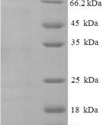 SDS-PAGE separation of QP7849 followed by commassie total protein stain results in a primary band consistent with reported data for CXCL10 / Crg-2. These data demonstrate Greater than 90% as determined by SDS-PAGE.