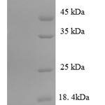 SDS-PAGE separation of QP7858 followed by commassie total protein stain results in a primary band consistent with reported data for DENN domain-containing protein 1A. These data demonstrate Greater than 90% as determined by SDS-PAGE.