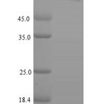 SDS-PAGE separation of QP7868 followed by commassie total protein stain results in a primary band consistent with reported data for PNPLA2. These data demonstrate Greater than 80% as determined by SDS-PAGE.