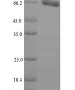 SDS-PAGE separation of QP7868 followed by commassie total protein stain results in a primary band consistent with reported data for PNPLA2. These data demonstrate Greater than 80% as determined by SDS-PAGE.