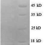 SDS-PAGE separation of QP7872 followed by commassie total protein stain results in a primary band consistent with reported data for Probable ATP-dependent RNA helicase DDX27. These data demonstrate Greater than 90% as determined by SDS-PAGE.