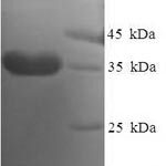 SDS-PAGE separation of QP7875 followed by commassie total protein stain results in a primary band consistent with reported data for DYDC2 / DPY30 domain containing 2. These data demonstrate Greater than 90% as determined by SDS-PAGE.