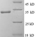 SDS-PAGE separation of QP7890 followed by commassie total protein stain results in a primary band consistent with reported data for IL1F10 / IL-38. These data demonstrate Greater than 90% as determined by SDS-PAGE.