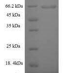 SDS-PAGE separation of QP7894 followed by commassie total protein stain results in a primary band consistent with reported data for Phospholipase D4. These data demonstrate Greater than 90% as determined by SDS-PAGE.