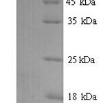 SDS-PAGE separation of QP7906 followed by commassie total protein stain results in a primary band consistent with reported data for CCL20 / MIP-3 alpha. These data demonstrate Greater than 90% as determined by SDS-PAGE.