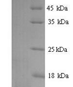 SDS-PAGE separation of QP7906 followed by commassie total protein stain results in a primary band consistent with reported data for CCL20 / MIP-3 alpha. These data demonstrate Greater than 90% as determined by SDS-PAGE.