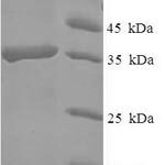 SDS-PAGE separation of QP7908 followed by commassie total protein stain results in a primary band consistent with reported data for CLEC4D / CLECSF8. These data demonstrate Greater than 90% as determined by SDS-PAGE.