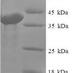 SDS-PAGE separation of QP7914 followed by commassie total protein stain results in a primary band consistent with reported data for ABHD14B. These data demonstrate Greater than 90% as determined by SDS-PAGE.