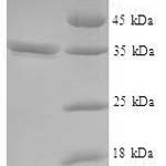 SDS-PAGE separation of QP7916 followed by commassie total protein stain results in a primary band consistent with reported data for VSTM2L. These data demonstrate Greater than 90% as determined by SDS-PAGE.