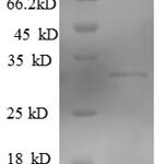 SDS-PAGE separation of QP7938 followed by commassie total protein stain results in a primary band consistent with reported data for KLRG1. These data demonstrate Greater than 90% as determined by SDS-PAGE.