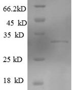 SDS-PAGE separation of QP7938 followed by commassie total protein stain results in a primary band consistent with reported data for KLRG1. These data demonstrate Greater than 90% as determined by SDS-PAGE.