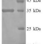 SDS-PAGE separation of QP7944 followed by commassie total protein stain results in a primary band consistent with reported data for Protein disulfide-isomerase TMX3. These data demonstrate Greater than 90% as determined by SDS-PAGE.