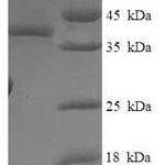 SDS-PAGE separation of QP7959 followed by commassie total protein stain results in a primary band consistent with reported data for SOSS complex subunit B2. These data demonstrate Greater than 90% as determined by SDS-PAGE.