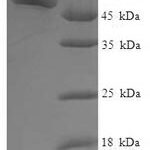 SDS-PAGE separation of QP7961 followed by commassie total protein stain results in a primary band consistent with reported data for Aldose 1-epimerase. These data demonstrate Greater than 90% as determined by SDS-PAGE.