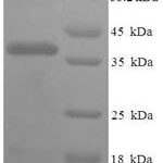 SDS-PAGE separation of QP7973 followed by commassie total protein stain results in a primary band consistent with reported data for Fin bud initiation factor homolog. These data demonstrate Greater than 90% as determined by SDS-PAGE.