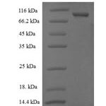 SDS-PAGE separation of QP8005 followed by commassie total protein stain results in a primary band consistent with reported data for CNDP2 / CPGL / PEPA. These data demonstrate Greater than 90% as determined by SDS-PAGE.