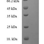 SDS-PAGE separation of QP8008 followed by commassie total protein stain results in a primary band consistent with reported data for PNKP. These data demonstrate Greater than 90% as determined by SDS-PAGE.