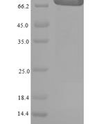 SDS-PAGE separation of QP8014 followed by commassie total protein stain results in a primary band consistent with reported data for GRK2 / ADRBK1. These data demonstrate Greater than 90% as determined by SDS-PAGE.