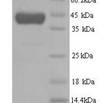 SDS-PAGE separation of QP8028 followed by commassie total protein stain results in a primary band consistent with reported data for Methionine synthase. These data demonstrate Greater than 90% as determined by SDS-PAGE.