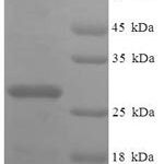 SDS-PAGE separation of QP8062 followed by commassie total protein stain results in a primary band consistent with reported data for 39S ribosomal protein L20