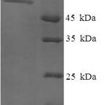 SDS-PAGE separation of QP8066 followed by commassie total protein stain results in a primary band consistent with reported data for Exonuclease V. These data demonstrate Greater than 90% as determined by SDS-PAGE.