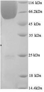 SDS-PAGE separation of QP8071 followed by commassie total protein stain results in a primary band consistent with reported data for BAG family molecular chaperone regulator 3. These data demonstrate Greater than 90% as determined by SDS-PAGE.