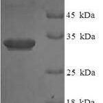 SDS-PAGE separation of QP8080 followed by commassie total protein stain results in a primary band consistent with reported data for IL1F5 / IL36RN. These data demonstrate Greater than 90% as determined by SDS-PAGE.