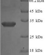 SDS-PAGE separation of QP8080 followed by commassie total protein stain results in a primary band consistent with reported data for IL1F5 / IL36RN. These data demonstrate Greater than 90% as determined by SDS-PAGE.