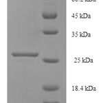 SDS-PAGE separation of QP8097 followed by commassie total protein stain results in a primary band consistent with reported data for Centrosomal protein of 126 kDa. These data demonstrate Greater than 90% as determined by SDS-PAGE.