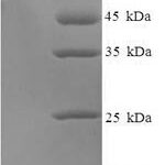 SDS-PAGE separation of QP8107 followed by commassie total protein stain results in a primary band consistent with reported data for DNA-directed RNA polymerase III subunit RPC3. These data demonstrate Greater than 90% as determined by SDS-PAGE.