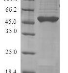 SDS-PAGE separation of QP8110 followed by commassie total protein stain results in a primary band consistent with reported data for GLO1 / Glyoxalase 1. These data demonstrate Greater than 80% as determined by SDS-PAGE.