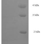 SDS-PAGE separation of QP8115 followed by commassie total protein stain results in a primary band consistent with reported data for Phylloquinone omega-hydroxylase CYP4F11. These data demonstrate Greater than 90% as determined by SDS-PAGE.