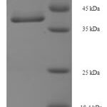 SDS-PAGE separation of QP8140 followed by commassie total protein stain results in a primary band consistent with reported data for Protein MIS12 homolog. These data demonstrate Greater than 90% as determined by SDS-PAGE.