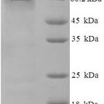 SDS-PAGE separation of QP8142 followed by commassie total protein stain results in a primary band consistent with reported data for CPVL / Carboxypeptidase. These data demonstrate Greater than 90% as determined by SDS-PAGE.