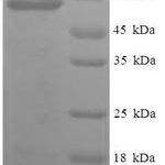 SDS-PAGE separation of QP8162 followed by commassie total protein stain results in a primary band consistent with reported data for PISD. These data demonstrate Greater than 90% as determined by SDS-PAGE.