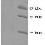 SDS-PAGE separation of QP8163 followed by commassie total protein stain results in a primary band consistent with reported data for Tubulin beta-6 chain. These data demonstrate Greater than 90% as determined by SDS-PAGE.