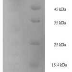 SDS-PAGE separation of QP8169 followed by commassie total protein stain results in a primary band consistent with reported data for Gp2. These data demonstrate Greater than 90% as determined by SDS-PAGE.