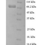 SDS-PAGE separation of QP8175 followed by commassie total protein stain results in a primary band consistent with reported data for Leucine-rich repeat-containing protein 40. These data demonstrate Greater than 90% as determined by SDS-PAGE.