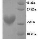 SDS-PAGE separation of QP8176 followed by commassie total protein stain results in a primary band consistent with reported data for Nqo2. These data demonstrate Greater than 90% as determined by SDS-PAGE.