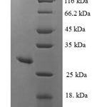 SDS-PAGE separation of QP8191 followed by commassie total protein stain results in a primary band consistent with reported data for MSRA. These data demonstrate Greater than 90% as determined by SDS-PAGE.