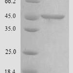 SDS-PAGE separation of QP8193 followed by commassie total protein stain results in a primary band consistent with reported data for Chitinase domain-containing protein 1. These data demonstrate Greater than 90% as determined by SDS-PAGE.