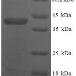 SDS-PAGE separation of QP8206 followed by commassie total protein stain results in a primary band consistent with reported data for VTI1B. These data demonstrate Greater than 90% as determined by SDS-PAGE.