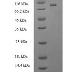 SDS-PAGE separation of QP8225 followed by commassie total protein stain results in a primary band consistent with reported data for ATP-dependent RNA helicase DDX19A. These data demonstrate Greater than 90% as determined by SDS-PAGE.