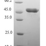 SDS-PAGE separation of QP8227 followed by commassie total protein stain results in a primary band consistent with reported data for Myosin regulatory light chain 2